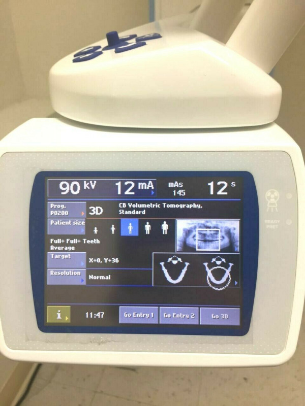 Used Planmeca Promax Classic 3d With Smart Pan For Sale In Usa